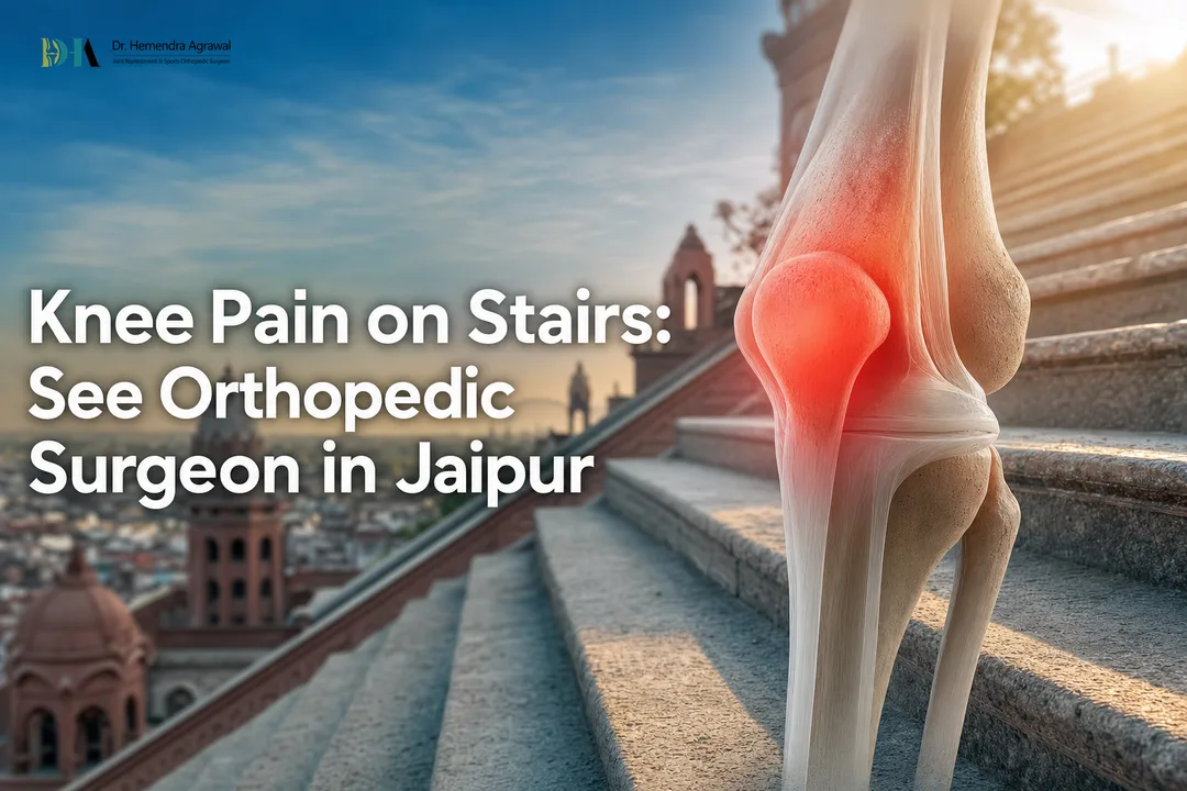 Knee Pain on Stairs: See Orthopedic Surgeon in Jaipur